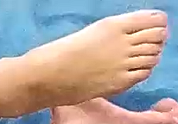 Auriel foot 3