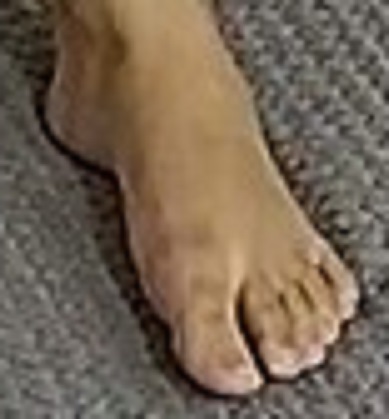 foot Faye 3-10-23